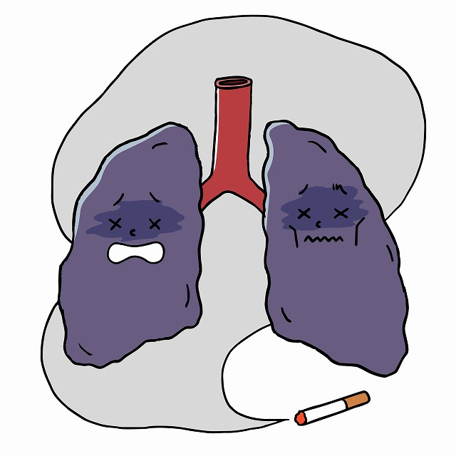 COPD